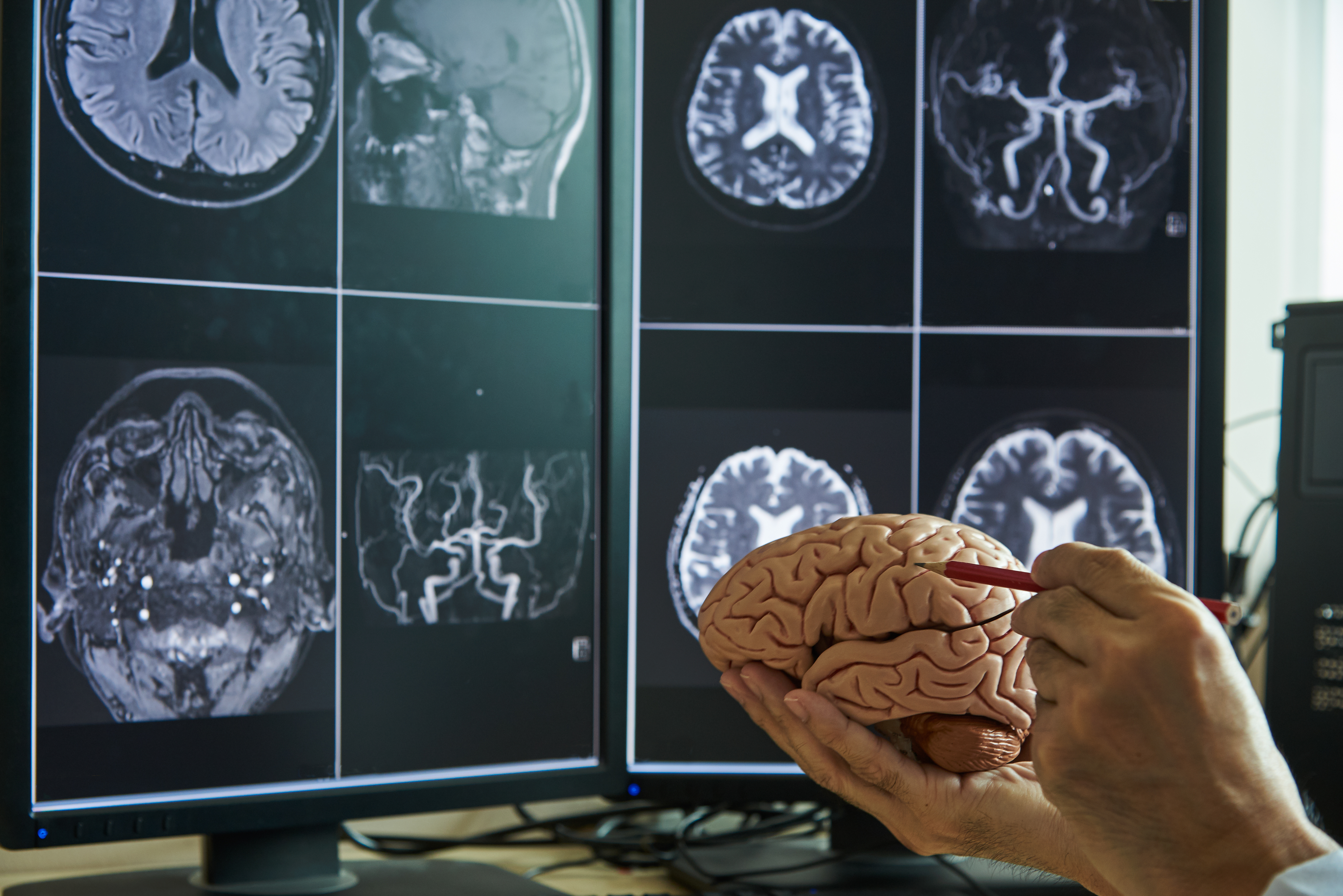 Gray matter application